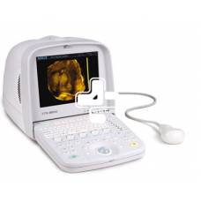 سونوگرافی سویی SIUI مدل CTS500